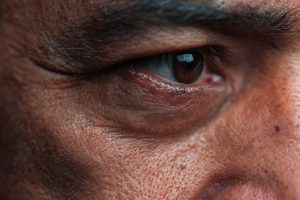 Quels sont les symptômes d’un manque de probiotiques ?